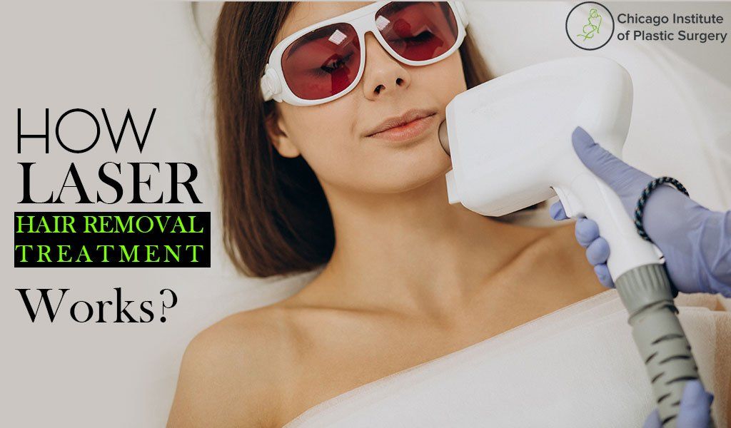 What is Laser Hair Removal How Laser Hair Removal Treatment Works